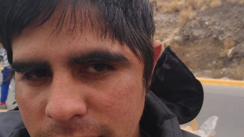 Familiares se manifiestan para pedir la prótesis para el joven accidentado