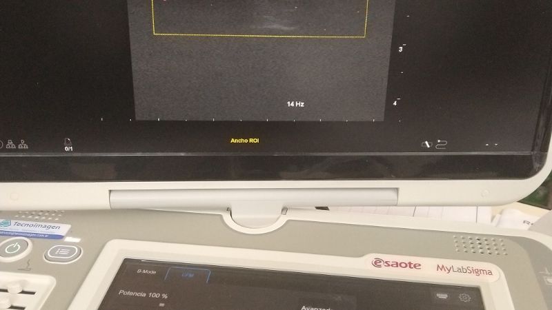 Estudios de Ecopower en el Hospital San Juan