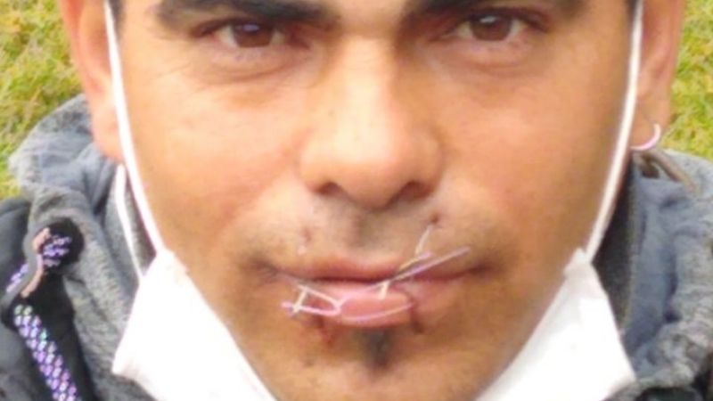 Se encadenó y cosió la boca por estabilidad laboral