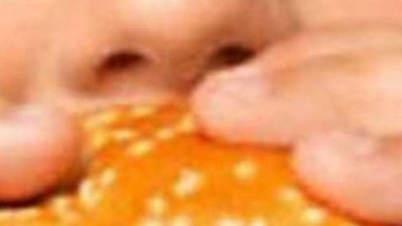 El 40% de los chicos en Argentina tiene exceso de peso