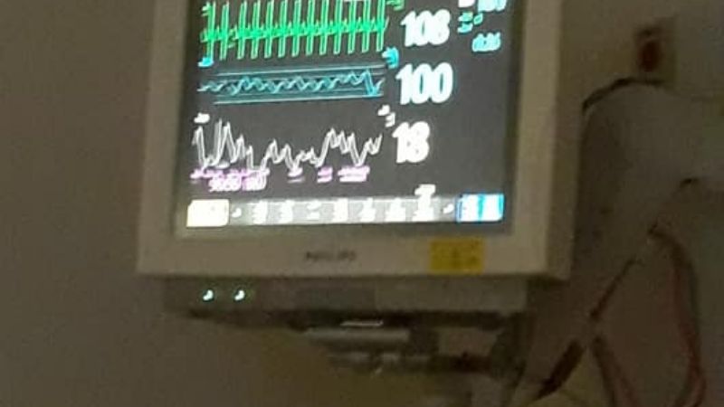 Operaron exitosamente a Fermín