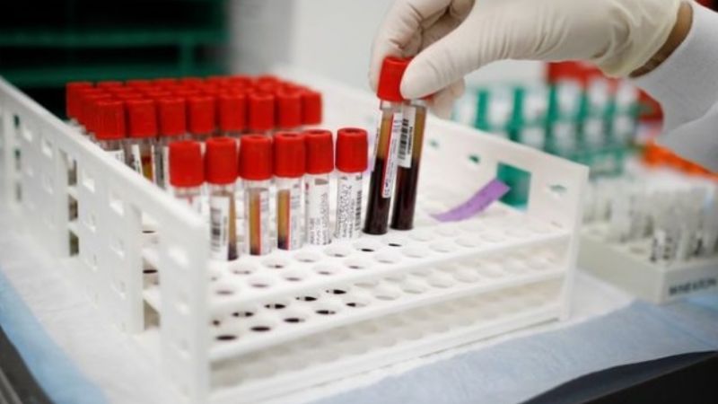 Descubren que más del 80% tiene deficiencia de vitamina D