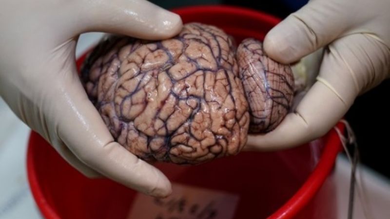 El cerebro de algunos pacientes podría envejecer hasta 10 años
