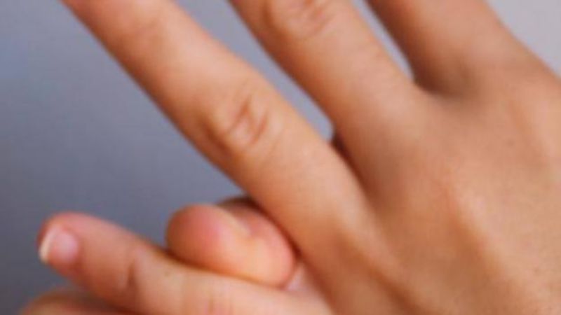 El síndrome de los "dedos congelados", un nuevo síntoma de coronavirus