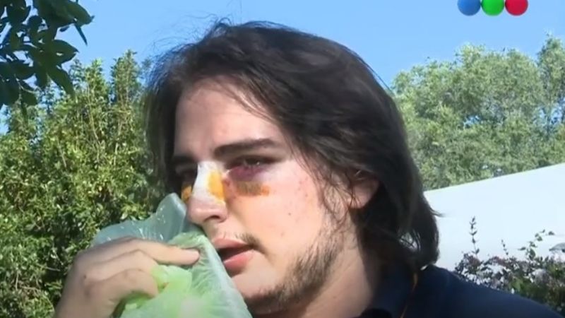 Denuncian a rugbiers por brutal golpiza en una fiesta a la que entraron colados