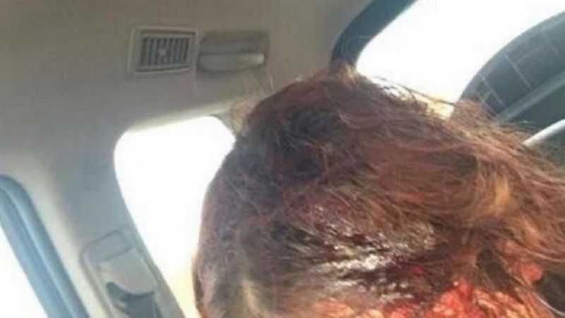 Atacó a dos jóvenes con un machete porque lo “tiene harto el 8M”