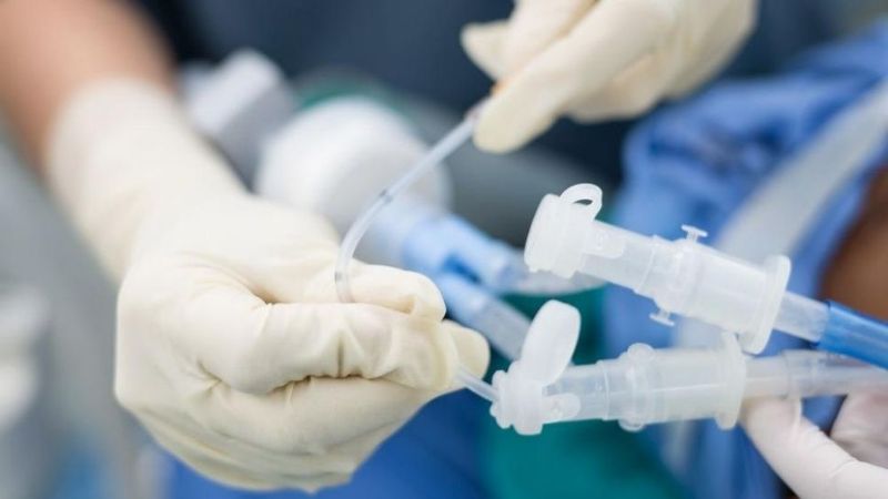 Sin escrúpulos: millonarios compraron respiradores para sus mansiones