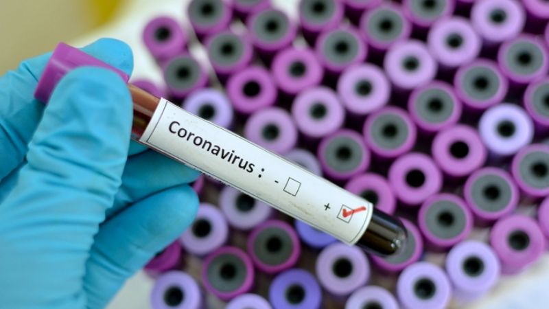 Confirmaron 132 nuevos casos de coronavirus en la Argentina