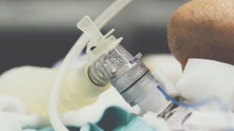 ¿Qué es la neumonía atípica y su relación con el Covid-19?