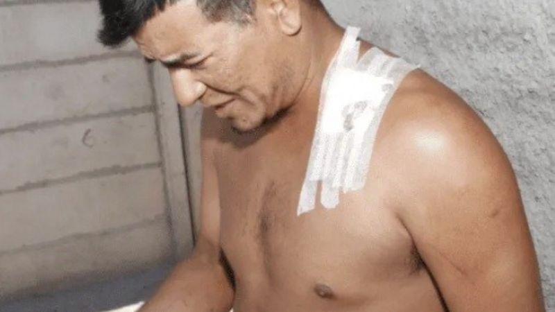 “Aca estoy con mi tóxica” La pareja de este hombre lo apuñaló en el cuello y a las horas volvió con ella