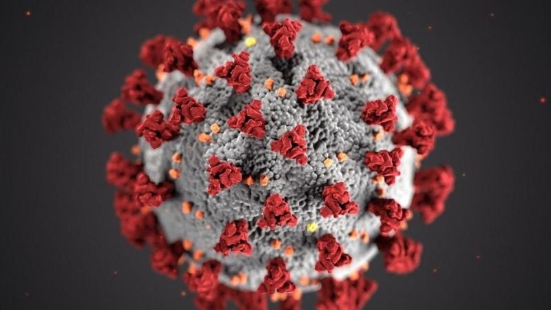 El coronavirus provocaría ACV en infectados asintomáticos