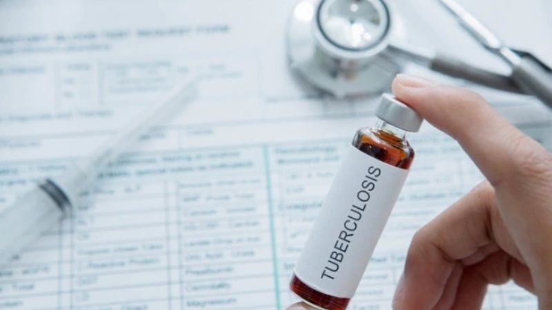 La vacuna BCG reduce la tasa de mortalidad por coronavirus, afirma un estudio