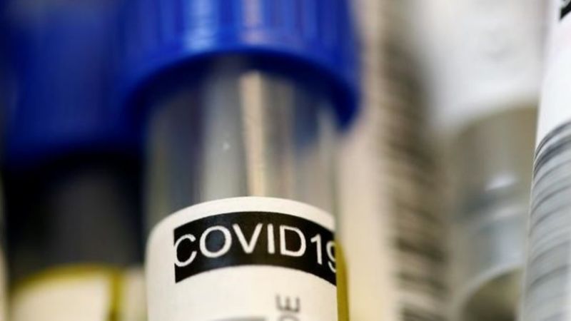 Cinco casos sospechosos dieron negativo y Catamarca sigue sin Covid-19