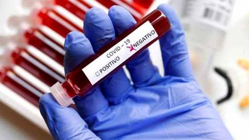 Catamarca sin coronavirus: 30 muestras con resultados negativos