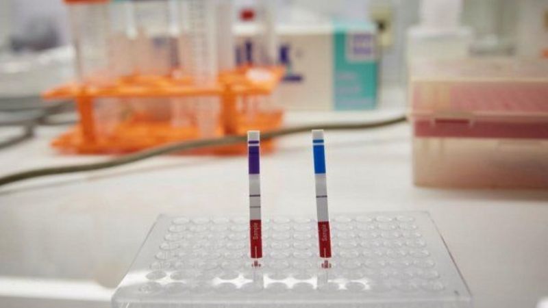 Científicos argentinos crean un test que detecta el coronavirus con o sin síntomas
