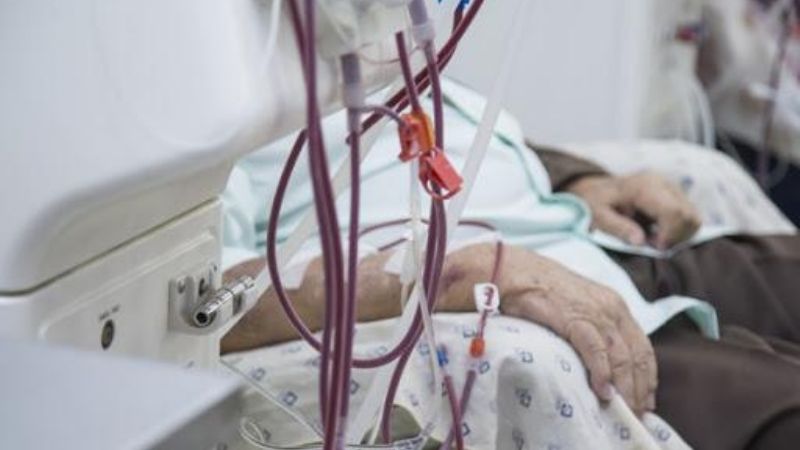 De 30 mil personas que hacen diálisis en el país, 148 contrajeron Covid