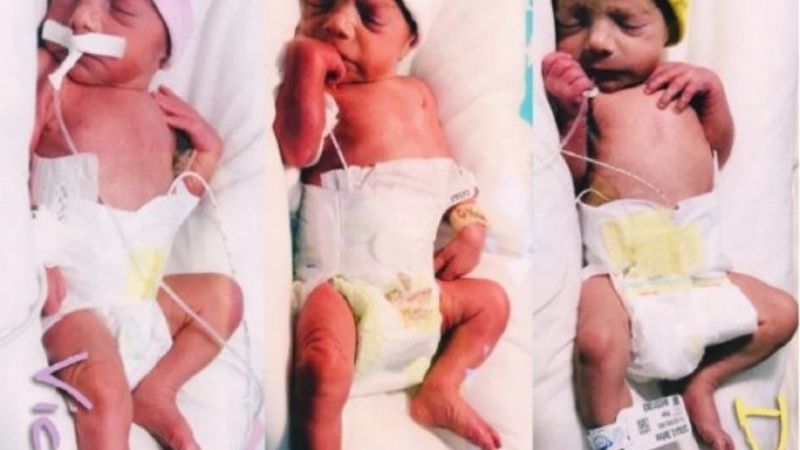 Increíble: nacieron trigemelas idénticas