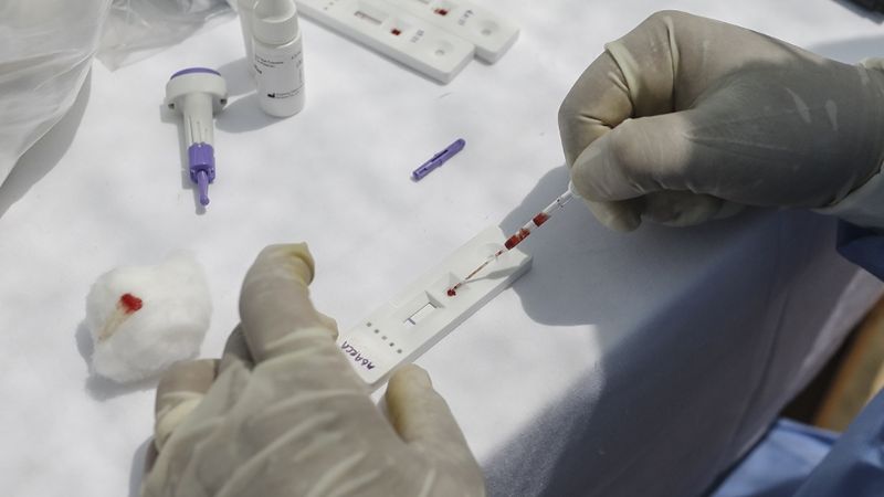 Cervecería informo el resultado de los análisis de los casos sospechosos