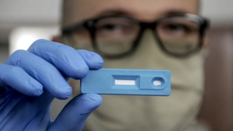 ANMAT aprobó el primer test argentino para la detección rápida