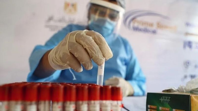 Coronavirus: ¿Qué busca probar estudio de anticuerpos en vacunados?