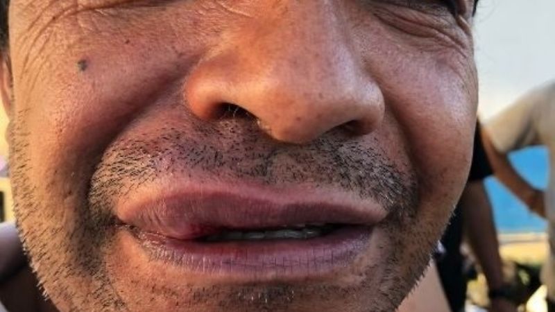 Veteranos terminaron a las piñas, en medio de graves incidentes