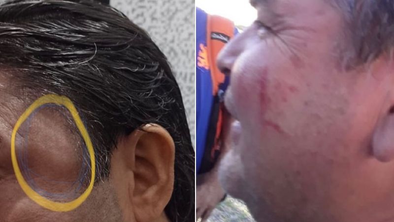 Veteranos terminaron a las piñas, en medio de graves incidentes