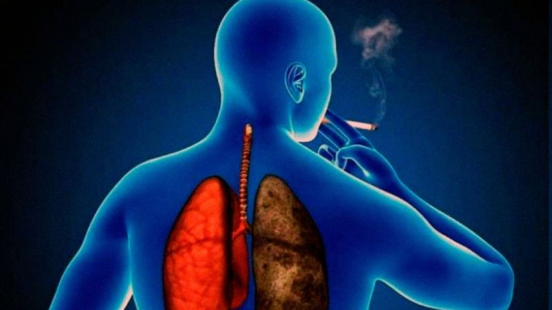 Día Mundial de la Enfermedad Pulmonar Obstructiva Crónica