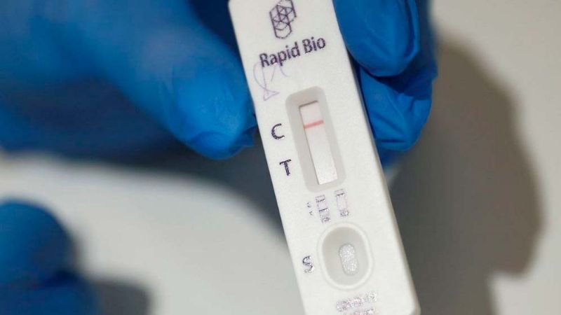 Para los bioquímicos, el autotest "es un gran problema"