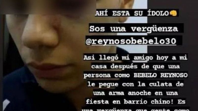 Bebelo Reynoso detenido por agredir a un menor