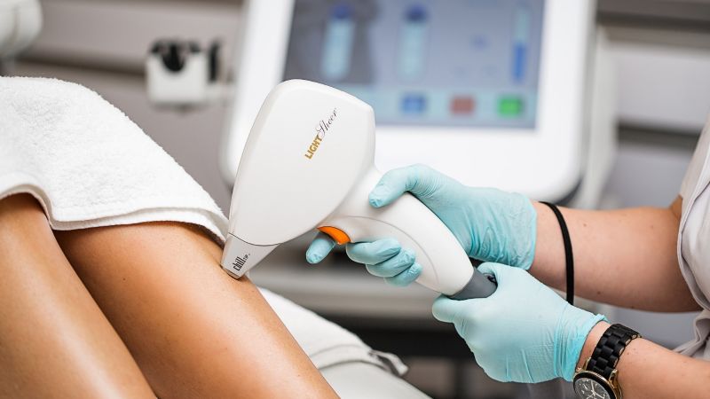 Sale del mercado, equipo de depilación láser falsificado