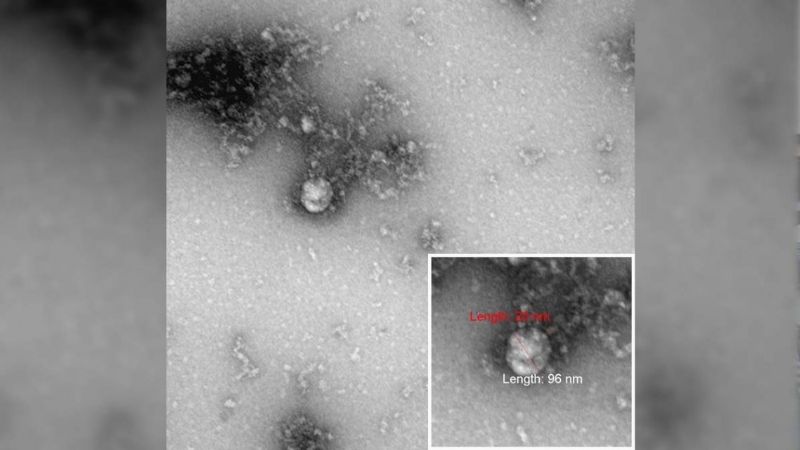 Detectan cepa sudafricana de coronavirus en 19 países europeos
