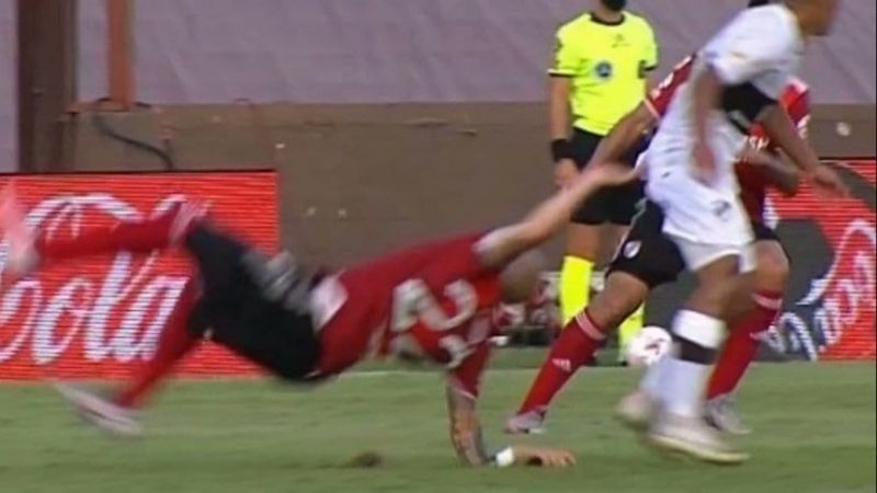 Pinola se fracturó el antebrazo en una caída