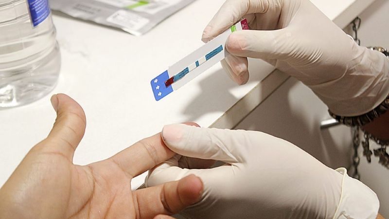 Creen haber encontrado al paciente cero del HIV