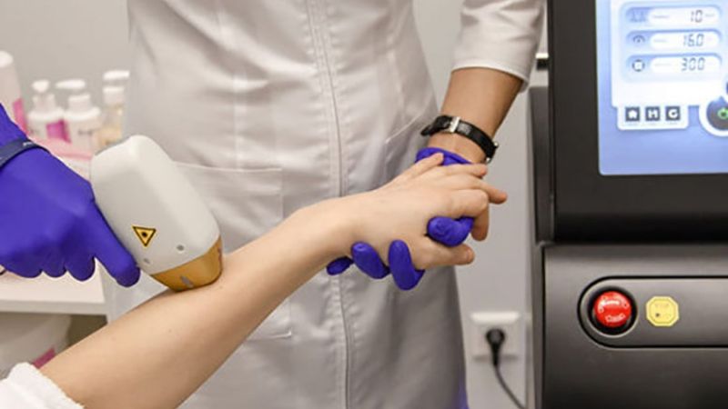 Prohíben el uso y la comercialización de un equipo de depilación láser