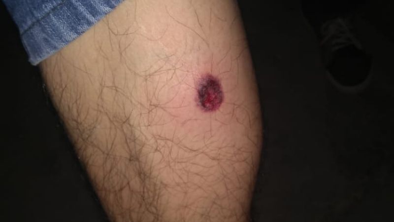 Viñateros de Medanitos denuncian represión policial