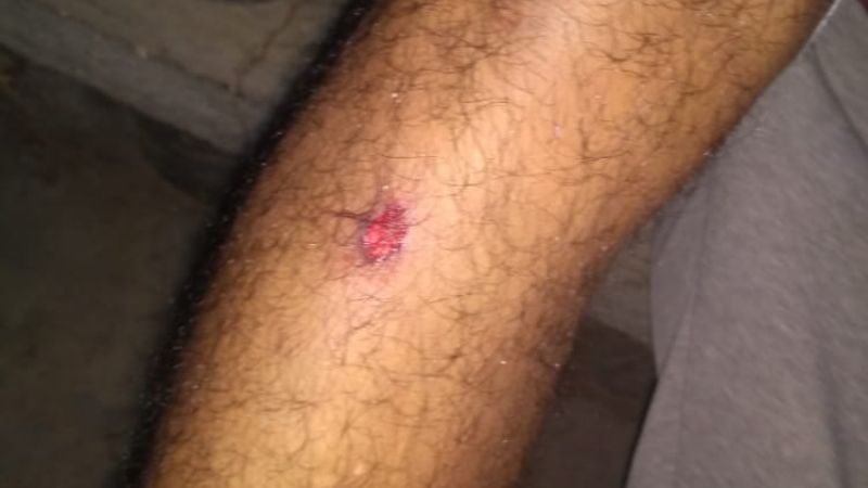 Viñateros de Medanitos denuncian represión policial