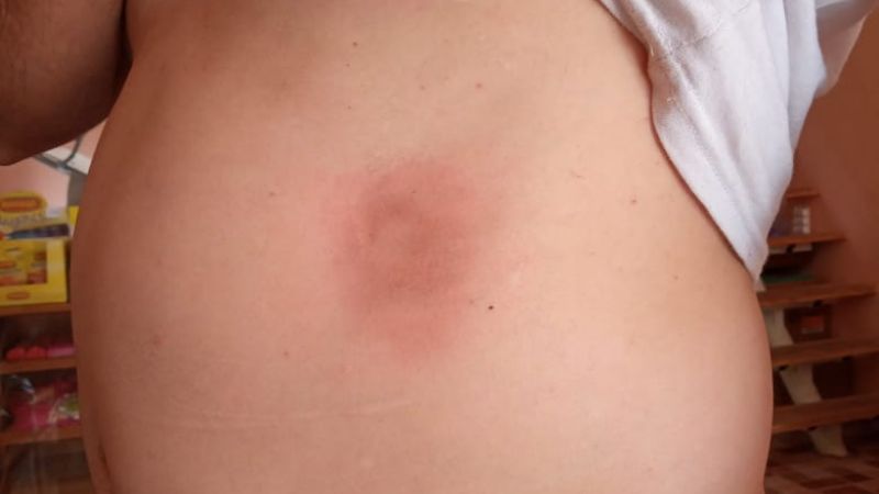 Denunció que lo reprimieron por orden del intendente Córdoba