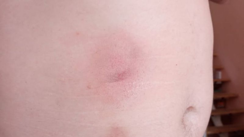 Denunció que lo reprimieron por orden del intendente Córdoba