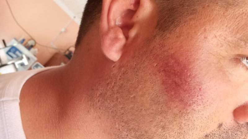 Denunció que lo reprimieron por orden del intendente Córdoba