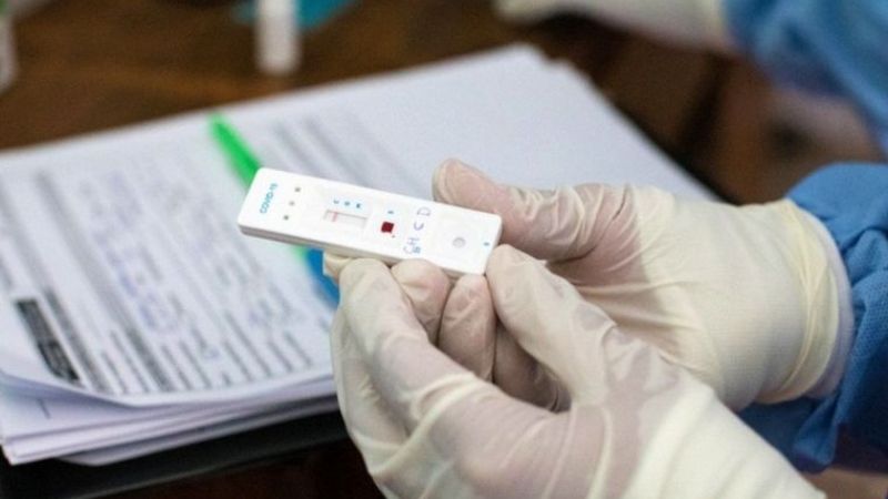 ANMAT aprobó la venta en farmacias del test rápido de Covid