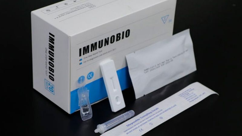 Bioquímicos rechazan el test rápido de venta libre en farmacias