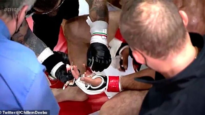 Perdió el dedo tras una patada de su rival y recién lo notaron en el segundo round