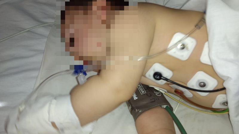 Un bebé hospitalizado tras ser picado por un alacrán