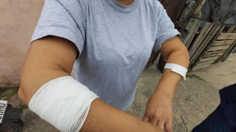 Lo denunció 200 veces, sigue libre y la apuñaló