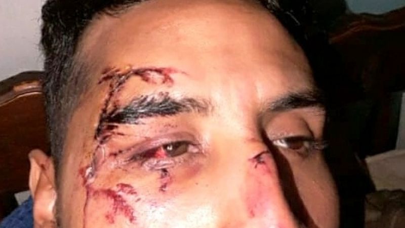 Tras un siniestro vial, reclaman a intendente que deje “de estar aplastado”