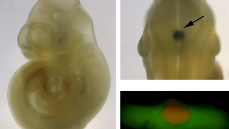Investigan el origen de una enfermedad congénita en infantes