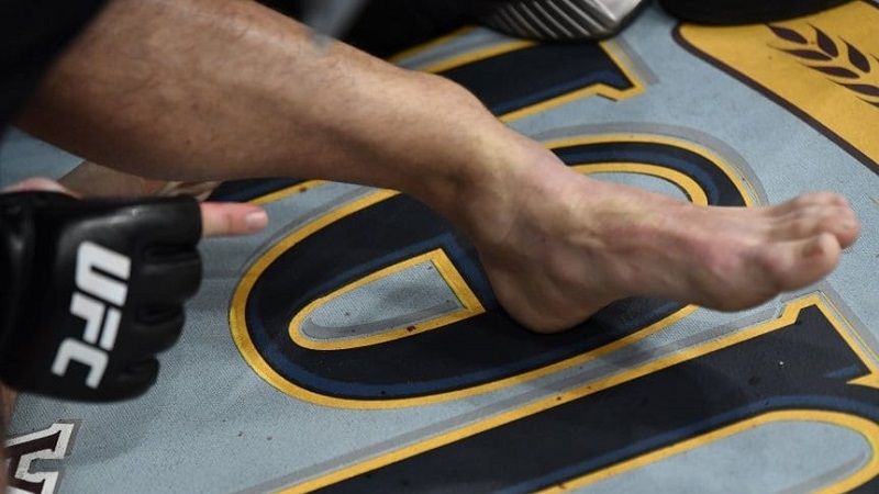 Terrible fractura de McGregor y derrota en el 1er. round