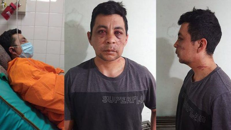 Murió el enfermero que había sido atacado por sus vecinos al contagiarse