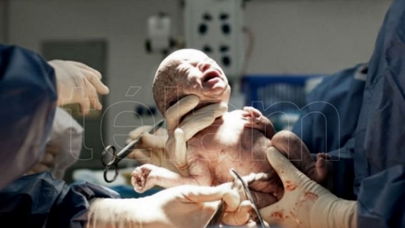 Nació en Argentina el primer bebé de Sudamérica por "transferencia de huso"