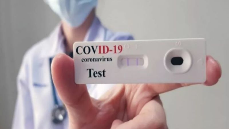 Los primeros autotest de Covid estarán disponibles en farmacias a $1.560
